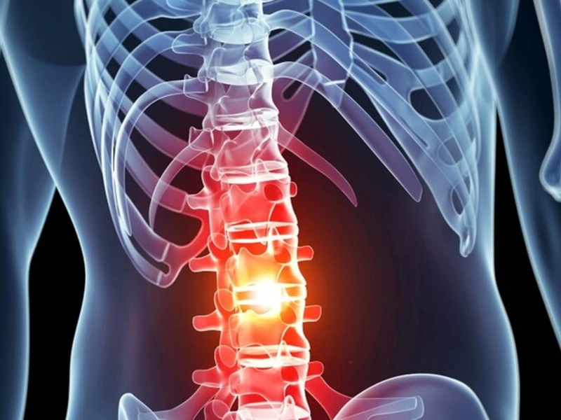 شکستگی پاتولوژیک