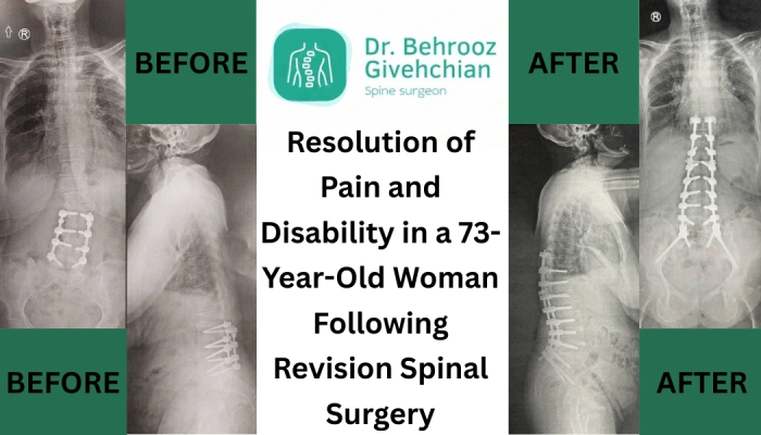 عمل مجدد ستون فقرات