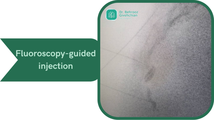 تزریق برای درد دنبالچه